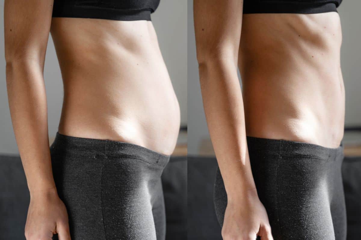 Post-Pregnancy: What Happens to Your Abdominal Muscles After Birth Waltham Forest