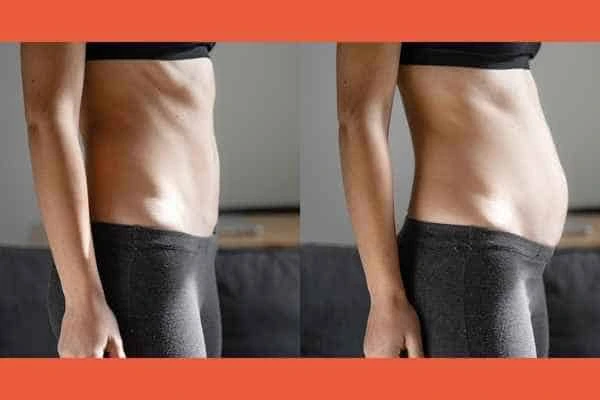 LA-EMS Body Sculpting results Waltham Forest