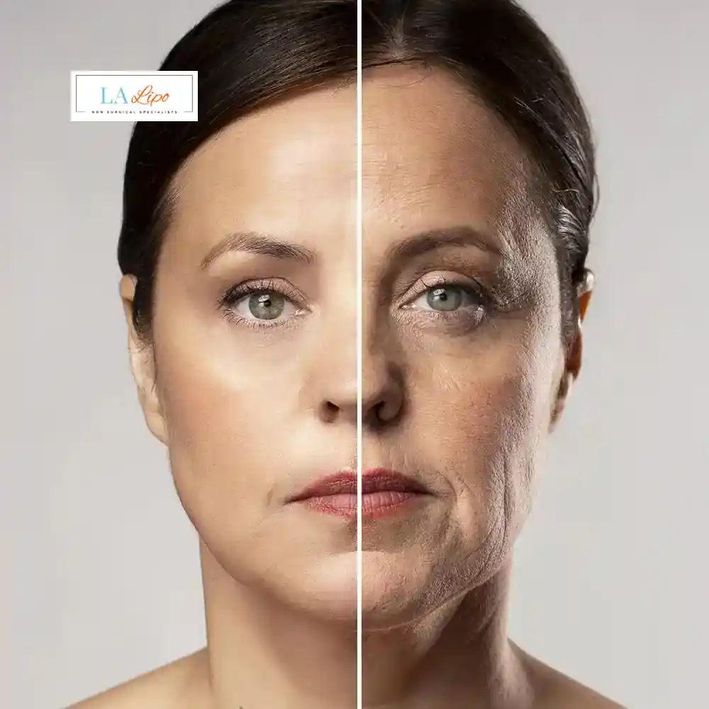 How Can You Tell If Non-Surgical Skin Tightening Is Right for You Waltham Forest?
