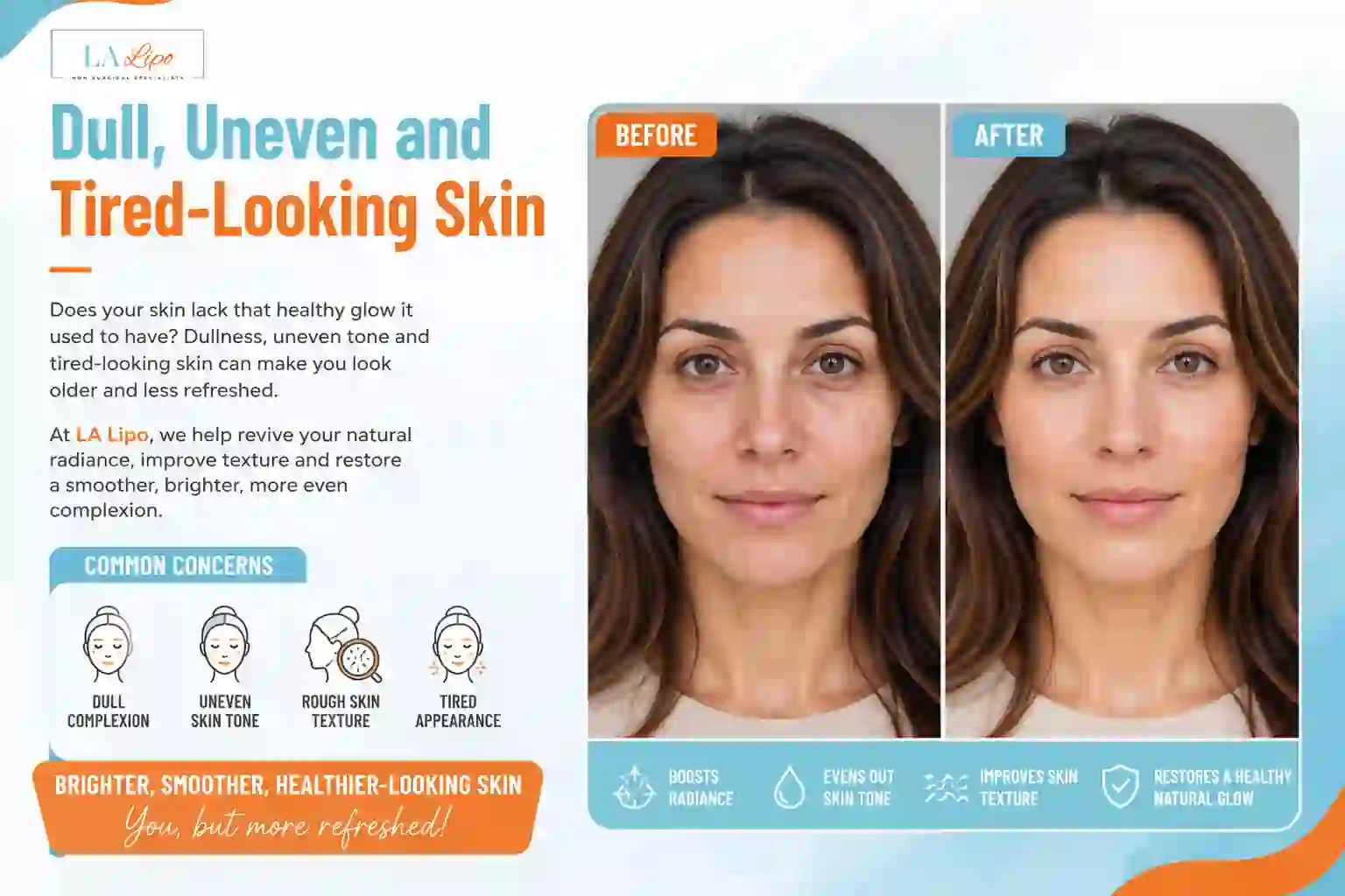 Sign #5: Dull, Uneven and Tired-Looking Skin Waltham Forest