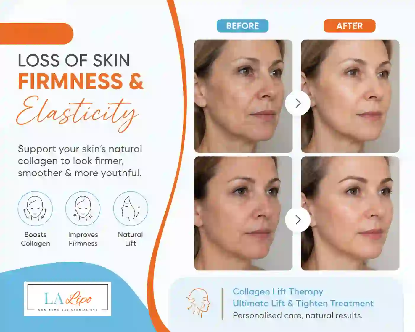 Sign #7: Loss of Skin Firmness and Elasticity Waltham Forest