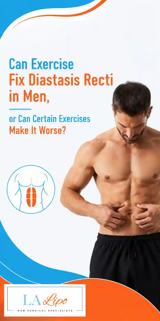 Can Exercise Fix Diastasis Recti in Men, or Can Certain Exercises Make It Worse Waltham Forest?
