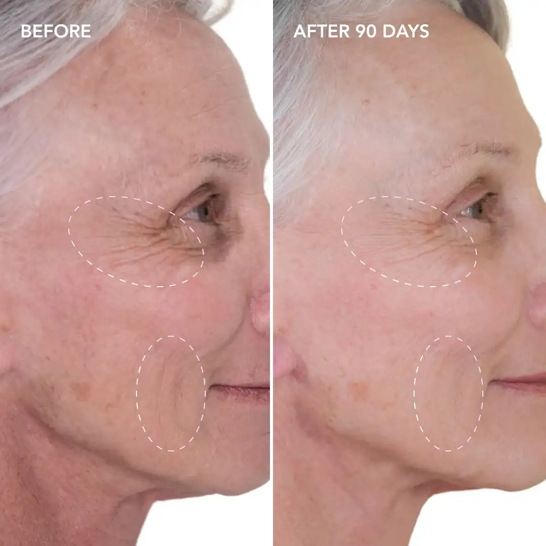 When will you see results Waltham Forest